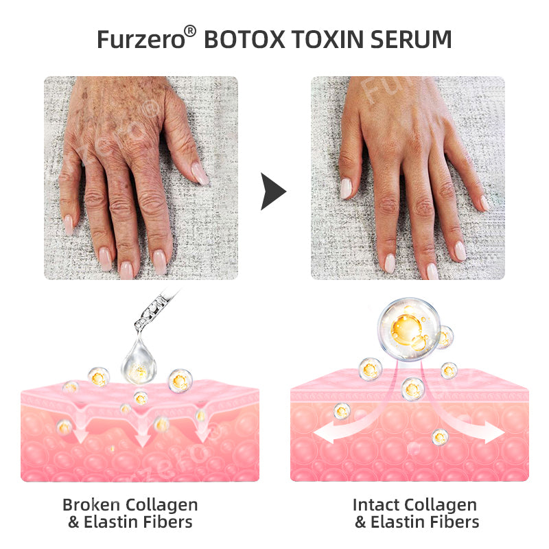 šš¦ćOfficial StorećFurzeroĀ® Botox Toxin Serum(š„Remove wrinkles, dark spots, scars, acne, and tighten skin)