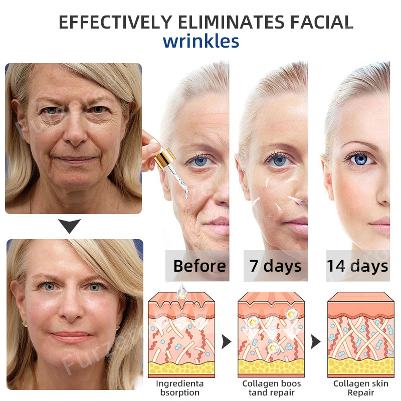 šš¦ćOfficial StorećFurzeroĀ® Botox Toxin Serum(š„Remove wrinkles, dark spots, scars, acne, and tighten skin)