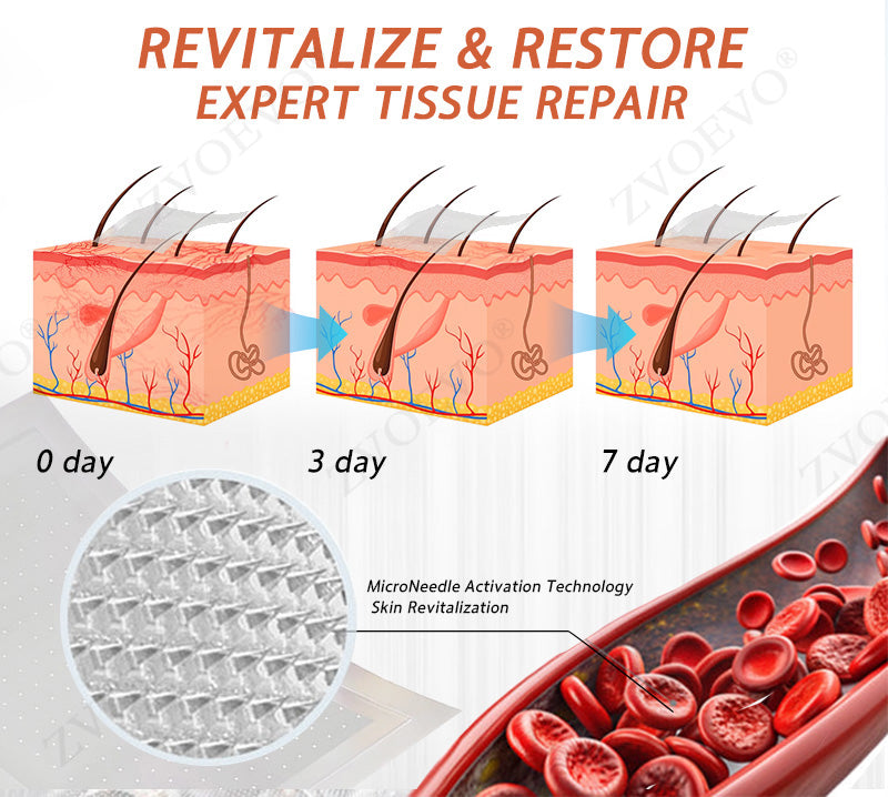 🎉🌟Zvoevo® Vein Ease Microneedle Care Patch(For Spider Veins, Varicose Veins, Swelling & Leg Fatigue)