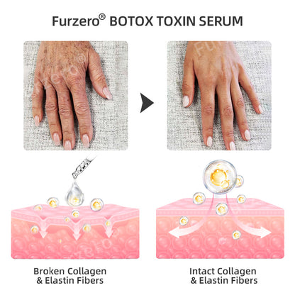 💉💦【Official Store】Furzero® Botox Toxin Serum(🔥Remove wrinkles, dark spots, scars, acne, and tighten skin)