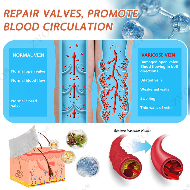 🎉🌟Zvoevo® Vein Ease Microneedle Care Patch(For Spider Veins, Varicose Veins, Swelling & Leg Fatigue)