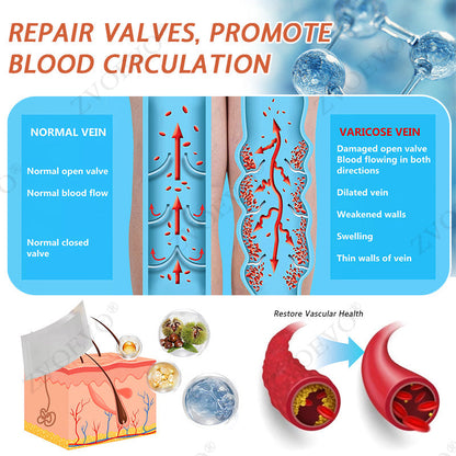 🎉🌟Zvoevo® Vein Ease Microneedle Care Patch(For Spider Veins, Varicose Veins, Swelling & Leg Fatigue)