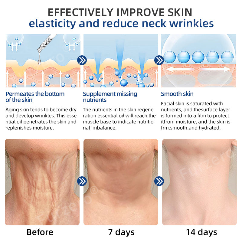 💉💦【Official Store】Furzero® Botox Toxin Serum(🔥Remove wrinkles, dark spots, scars, acne, and tighten skin)