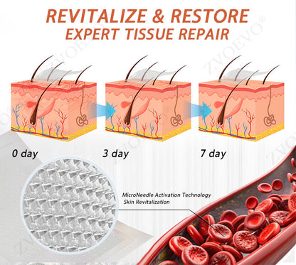 🎉🌟Zvoevo® Vein Ease Microneedle Care Patch(For Spider Veins, Varicose Veins, Swelling & Leg Fatigue)
